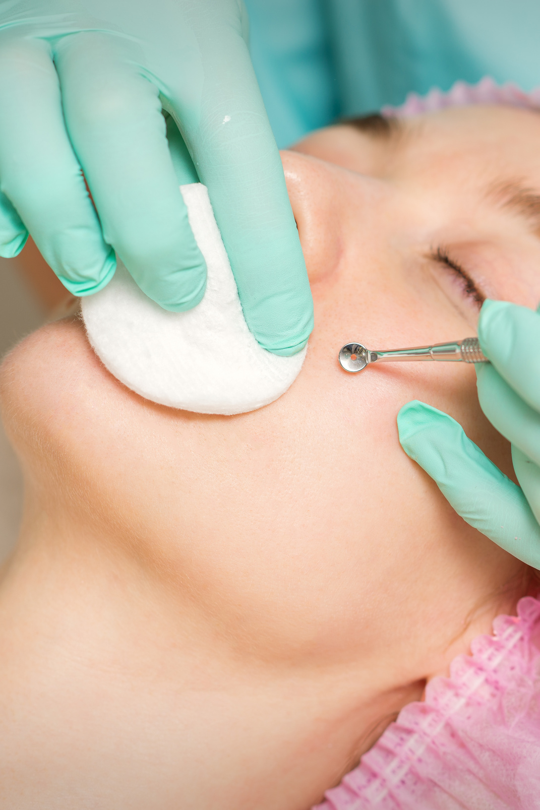 The Beautician Removes Blackhead and Acne on the Female Face in a Beauty Salon, Blackhead Removal Tool.
